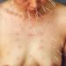 He Chengyao, 99 Needles, performance photograph, 2002. 99 Needles